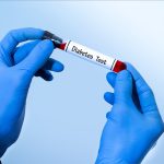 فهم تحليل السكر المبكر