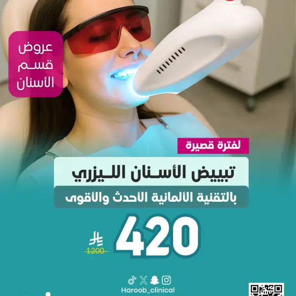 عرض تبييض الأسنان الليزري بالتقنية الألمانية